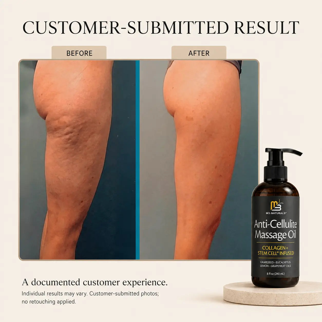 Anti-Cellulite Massage Oil
