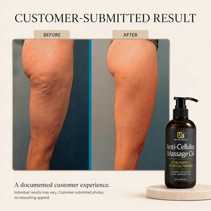 Anti-Cellulite Massage Oil